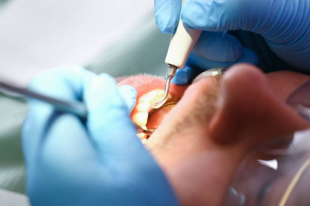 Best Knocked-Out Tooth Emergency  in Ashwaubenon, WI