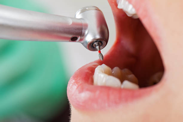 Best Cracked Tooth Emergency Dentist  in Ashwaubenon, WI
